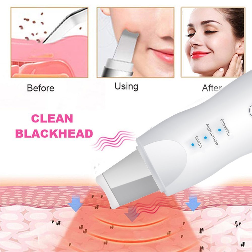 Appareil Ultrasonic purificateur points noir 3en1 lifting-8815 - الصورة 2