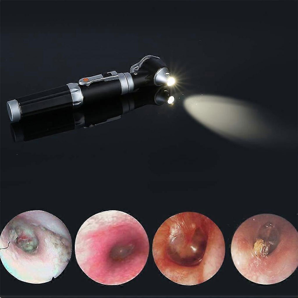 Otoscope 3X avec LED loupe de contrôle d’oreille portable avec 8 capuchons – جهاز فحص الأذن - الصورة 6