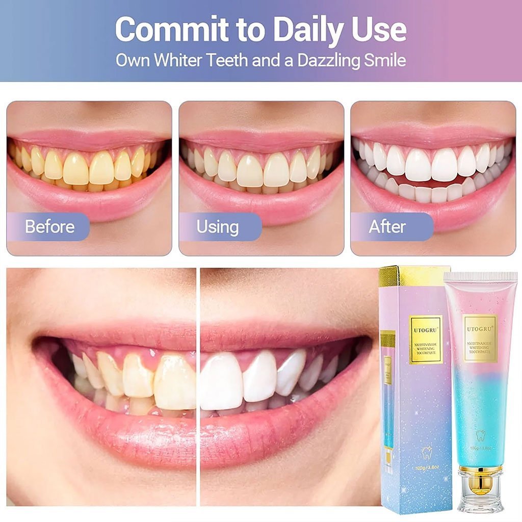 Dentifrice blanchissant à la niacinamide UTOGRU Triple action blanchissante – معجون تبييض الأسنان - الصورة 4