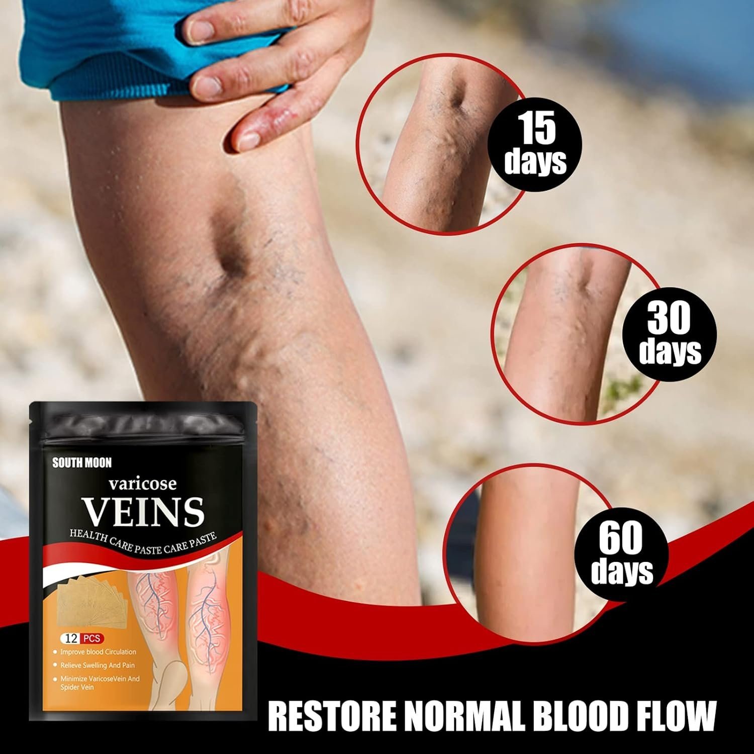 ⁦Patchs Herbales Anti-Varices Soulagement Douleur, Amélioration Circulation 12Pcs - لاصقات الأعشاب الطبيعية لعلاج الدوالي والدورة الدموية⁩ - الصورة ⁦3⁩