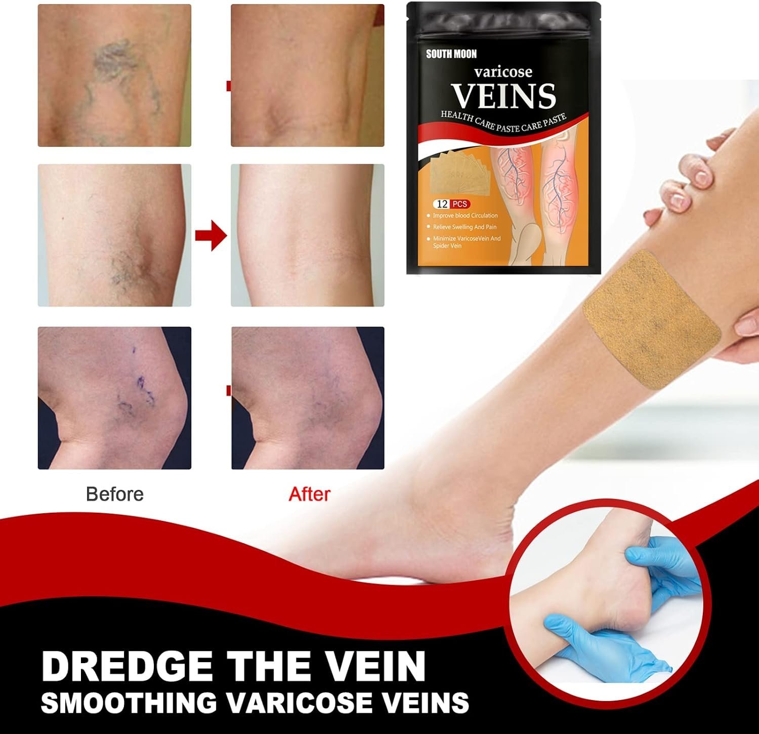 ⁦Patchs Herbales Anti-Varices Soulagement Douleur, Amélioration Circulation 12Pcs - لاصقات الأعشاب الطبيعية لعلاج الدوالي والدورة الدموية⁩ - الصورة ⁦4⁩
