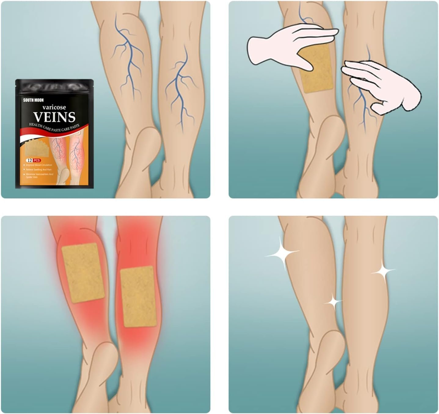 ⁦Patchs Herbales Anti-Varices Soulagement Douleur, Amélioration Circulation 12Pcs - لاصقات الأعشاب الطبيعية لعلاج الدوالي والدورة الدموية⁩ - الصورة ⁦5⁩